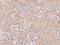 Myotubularin Related Protein 12 antibody, 200982-T08, Sino Biological, Immunohistochemistry paraffin image 