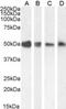 Thioredoxin Domain Containing 5 antibody, NB100-1452, Novus Biologicals, Western Blot image 