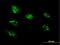Ribosome Biogenesis Regulator 1 Homolog antibody, H00023212-B02P, Novus Biologicals, Immunocytochemistry image 