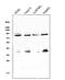 Glucuronidase Beta antibody, A02234-1, Boster Biological Technology, Western Blot image 