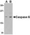 Caspase 6 antibody, TA306203, Origene, Western Blot image 