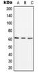 Proteasome 26S Subunit, Non-ATPase 3 antibody, orb214469, Biorbyt, Western Blot image 