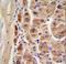 Aldehyde Dehydrogenase 1 Family Member A1 antibody, LS-C156252, Lifespan Biosciences, Immunohistochemistry frozen image 