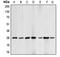 BCL2 antibody, MBS820604, MyBioSource, Western Blot image 