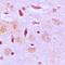Transmembrane Protein Adipocyte Associated 1 antibody, orb215367, Biorbyt, Immunohistochemistry paraffin image 