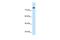 Salt Inducible Kinase 1 antibody, PA5-42799, Invitrogen Antibodies, Western Blot image 