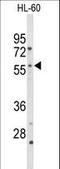 Cytochrome P450 Family 2 Subfamily C Member 19 antibody, LS-C167223, Lifespan Biosciences, Western Blot image 