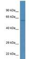 Tektin 3 antibody, NBP1-74181, Novus Biologicals, Western Blot image 