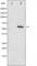 Estrogen Receptor 2 antibody, abx010750, Abbexa, Western Blot image 