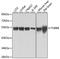 Tubulin Beta 8 Class VIII antibody, A12617, ABclonal Technology, Western Blot image 