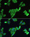 Solute carrier family 2, facilitated glucose transporter member 9 antibody, 15-626, ProSci, Immunofluorescence image 