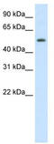 Death Inducer-Obliterator 1 antibody, TA345358, Origene, Western Blot image 