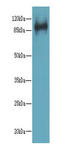 Transmembrane And Tetratricopeptide Repeat Containing 1 antibody, A66014-100, Epigentek, Western Blot image 