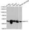 Keratin 18 antibody, LS-C746770, Lifespan Biosciences, Western Blot image 