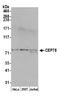 Centrosomal Protein 78 antibody, NB100-93341, Novus Biologicals, Western Blot image 