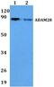 ADAM Metallopeptidase Domain 28 antibody, A06873, Boster Biological Technology, Western Blot image 