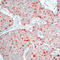 TIMP Metallopeptidase Inhibitor 1 antibody, LS-C88275, Lifespan Biosciences, Immunohistochemistry paraffin image 