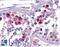 Spindle And Kinetochore Associated Complex Subunit 3 antibody, LS-B5039, Lifespan Biosciences, Immunohistochemistry paraffin image 