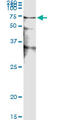 Serine/Threonine Kinase 38 antibody, LS-C133687, Lifespan Biosciences, Immunoprecipitation image 