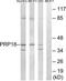 Pre-MRNA Processing Factor 18 antibody, TA314773, Origene, Western Blot image 