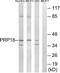 Pre-MRNA Processing Factor 18 antibody, TA314773, Origene, Western Blot image 