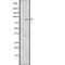 Ribosomal Protein S6 Kinase A3 antibody, abx217751, Abbexa, Western Blot image 