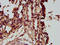 HECT Domain E3 Ubiquitin Protein Ligase 2 antibody, LS-C672384, Lifespan Biosciences, Immunohistochemistry paraffin image 