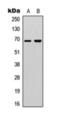 DEAD-Box Helicase 5 antibody, orb393266, Biorbyt, Western Blot image 