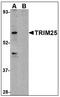 Tripartite Motif Containing 25 antibody, AP08929PU-N, Origene, Western Blot image 