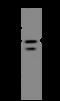 Nucleolar Protein 6 antibody, 205283-T32, Sino Biological, Western Blot image 