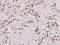 Snail Family Transcriptional Repressor 1 antibody, A00716-1, Boster Biological Technology, Immunohistochemistry frozen image 