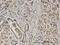 Eukaryotic Translation Initiation Factor 2 Subunit Beta antibody, LS-C133990, Lifespan Biosciences, Immunohistochemistry paraffin image 