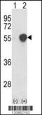 Phosphoglycerate Dehydrogenase antibody, 61-612, ProSci, Western Blot image 