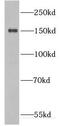 DExH-Box Helicase 57 antibody, FNab02382, FineTest, Western Blot image 