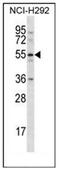 C-Type Lectin Domain Family 18 Member A antibody, AP50959PU-N, Origene, Western Blot image 