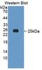 Enhancer Of Zeste 1 Polycomb Repressive Complex 2 Subunit antibody, abx131237, Abbexa, Western Blot image 