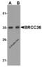 Lys-63-specific deubiquitinase BRCC36 antibody, 4331, ProSci Inc, Western Blot image 