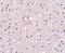 Presenilin 1 antibody, NBP1-76792, Novus Biologicals, Immunohistochemistry paraffin image 