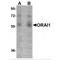 ORAI Calcium Release-Activated Calcium Modulator 1 antibody, NBP1-75522, Novus Biologicals, Western Blot image 