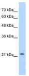 Distal-Less Homeobox 2 antibody, TA330202, Origene, Western Blot image 