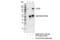 CYLD Lysine 63 Deubiquitinase antibody, 8462T, Cell Signaling Technology, Immunoprecipitation image 