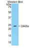 Fibrinogen Alpha Chain antibody, LS-C298360, Lifespan Biosciences, Western Blot image 