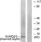 Small Ubiquitin Like Modifier 2 antibody, LS-B9279, Lifespan Biosciences, Western Blot image 