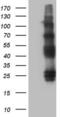 Protein C Receptor antibody, LS-C339639, Lifespan Biosciences, Western Blot image 