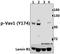 Vav Guanine Nucleotide Exchange Factor 1 antibody, A00691Y174, Boster Biological Technology, Western Blot image 
