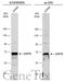 Zeta Chain Of T Cell Receptor Associated Protein Kinase 70 antibody, GTX101076, GeneTex, Western Blot image 