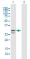 SCO Cytochrome C Oxidase Assembly Protein 2 antibody, H00009997-B01P, Novus Biologicals, Western Blot image 