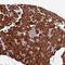 Trafficking Protein Particle Complex 6A antibody, NBP1-83167, Novus Biologicals, Immunohistochemistry paraffin image 