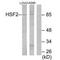 Heat Shock Transcription Factor 2 antibody, PA5-49820, Invitrogen Antibodies, Western Blot image 