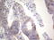 Galectin 3 antibody, LS-C339284, Lifespan Biosciences, Immunohistochemistry frozen image 